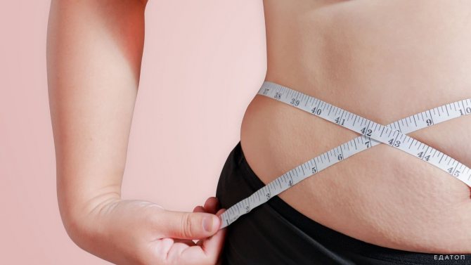 Ожирение - избыточные жировые отложения в подкожной клетчатке, органах и тканях.
